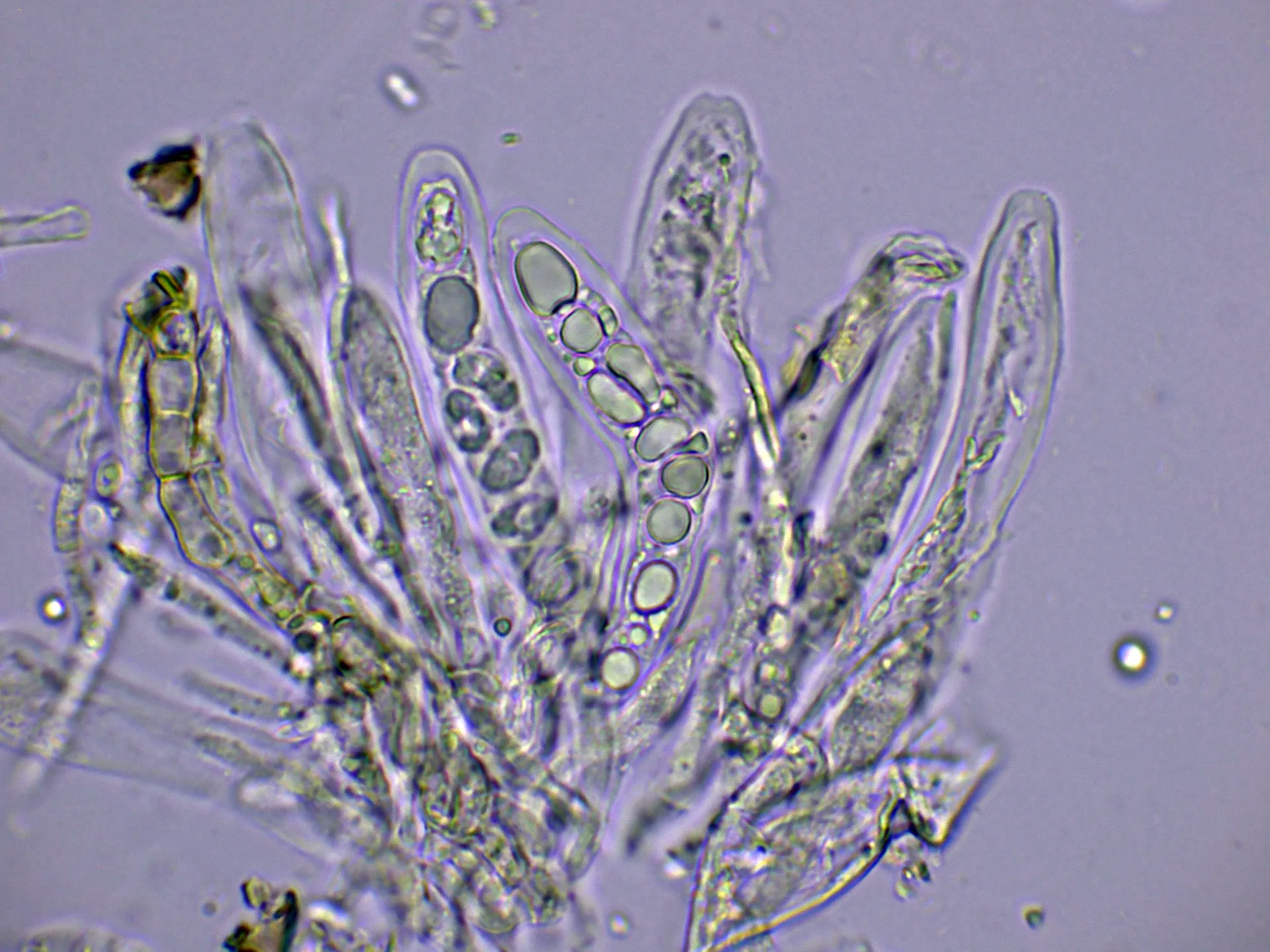 Microscopía de Trochila craterium - 12 - Ascos agua-003